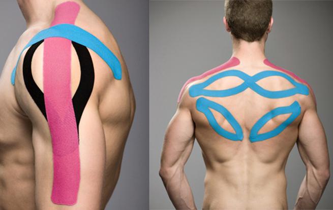 Тейпирование