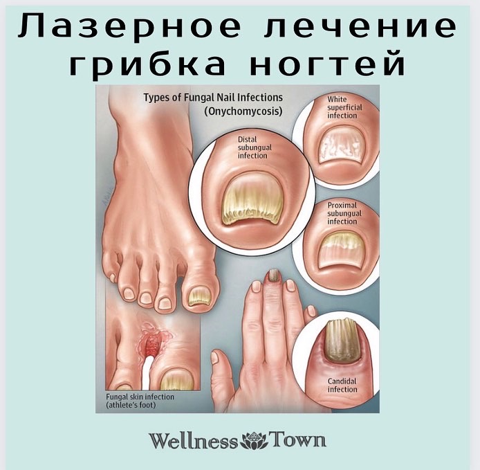 Wellness Town